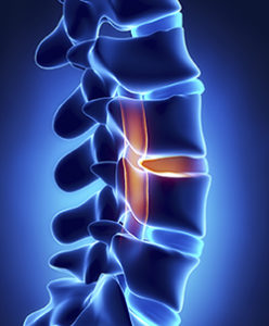 spine injuries